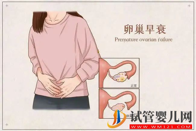 卵巢早衰跟這些因素相關(圖1)