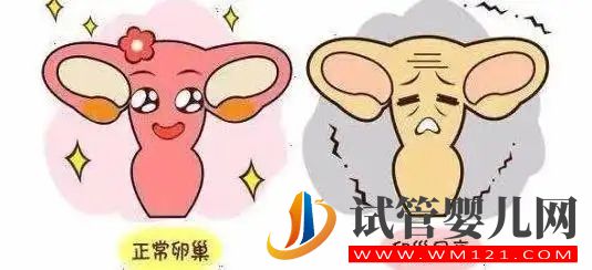 卵巢早衰更親睞哪些人?(圖1) 卵巢早衰更親睞哪些人?(圖1)