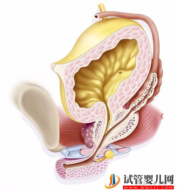 無精癥,需要進行哪些檢查(圖1)
