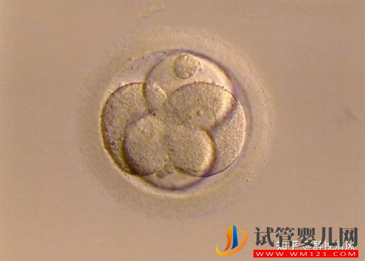 養(yǎng)囊主要看精子質(zhì)量嗎(圖1) 養(yǎng)囊主要看精子質(zhì)量嗎(圖1)