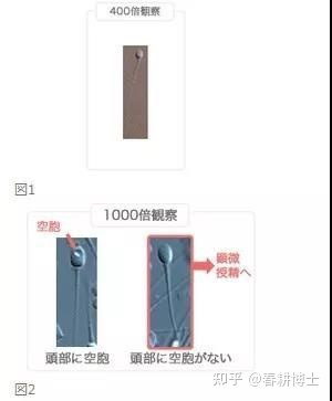 要不要養(yǎng)囊胚,如何提高養(yǎng)囊成功率(圖7) 要不要養(yǎng)囊胚,如何提高養(yǎng)囊成功率(圖7)