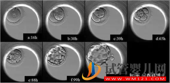 要不要養(yǎng)囊胚,如何提高養(yǎng)囊成功率(圖11) 要不要養(yǎng)囊胚,如何提高養(yǎng)囊成功率(圖11)