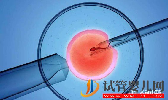 揭秘取卵全流程(附圖),腹部穿刺術只需10-20分鐘(圖2)