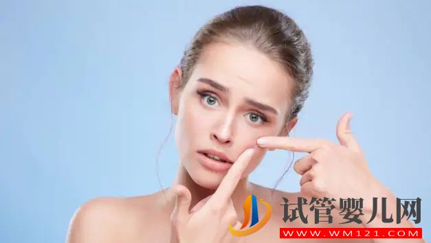 你有痣嗎？這是去除它們的 6 種正確方法(圖2)