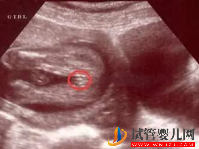 四維彩超男女參照圖對比，一看有這個特征是男寶幾率最大(圖2)