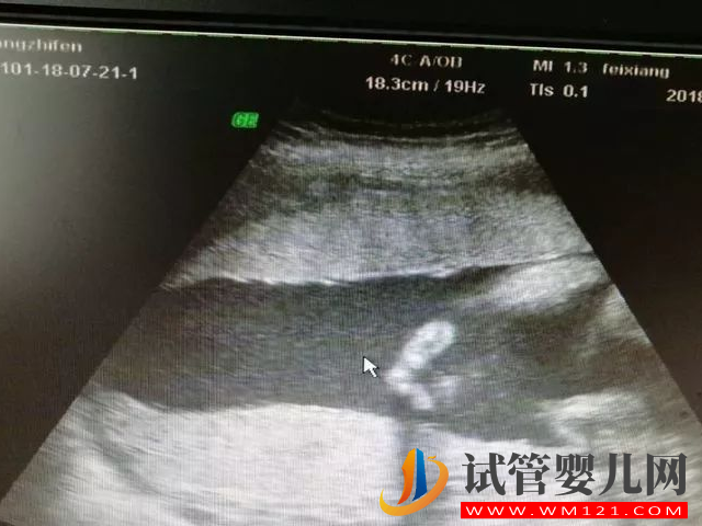 廣豐婦幼保健院四維彩超預約攻略，線上預約從容產檢更安心(圖2)