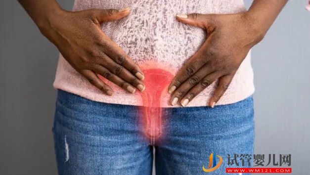 生殖健康問題：預(yù)防婦科病的正確方法！(圖2)