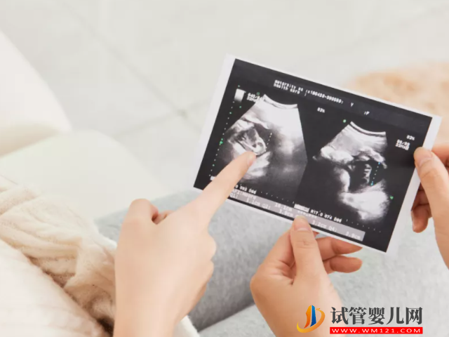 民間最靈預測生男生女方法大揭秘,舉例說明包教你看懂!(圖3) 民間最靈預測生男生女方法大揭秘,舉例說明包教你看懂!(圖3)