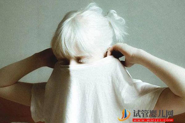 夫妻有白化病能做第幾代試管，你想要的答案都在這里！(圖1)