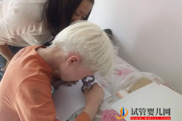 夫妻有白化病能做第幾代試管，你想要的答案都在這里！(圖2)