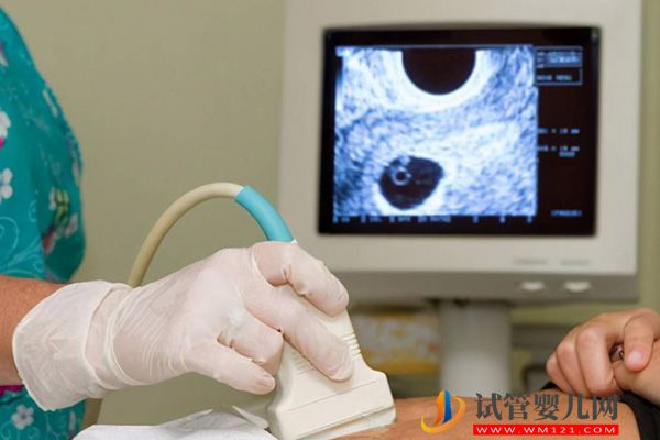 2023赴泰國(guó)供卵生子費(fèi)用明細(xì)表,預(yù)算10萬是最低線(圖2) 2023赴泰國(guó)供卵生子費(fèi)用明細(xì)表,預(yù)算10萬是最低線(圖2)