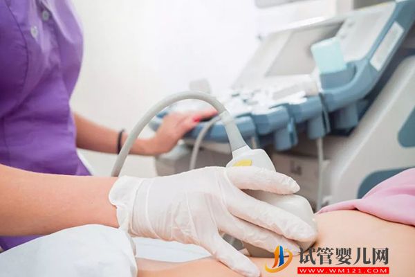 懷孕想知道男女這22個(gè)方法最簡(jiǎn)單,B超圖像自測(cè)準(zhǔn)確率高(圖1) 懷孕想知道男女這22個(gè)方法最簡(jiǎn)單,B超圖像自測(cè)準(zhǔn)確率高(圖1)