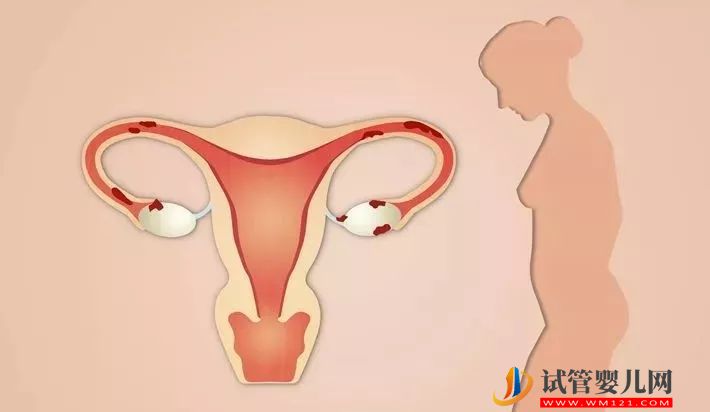 武漢女人習(xí)慣性流產(chǎn)會(huì)有哪些癥狀表現(xiàn)? 武漢女人習(xí)慣性流產(chǎn)會(huì)有哪些癥狀表現(xiàn)?(圖1)