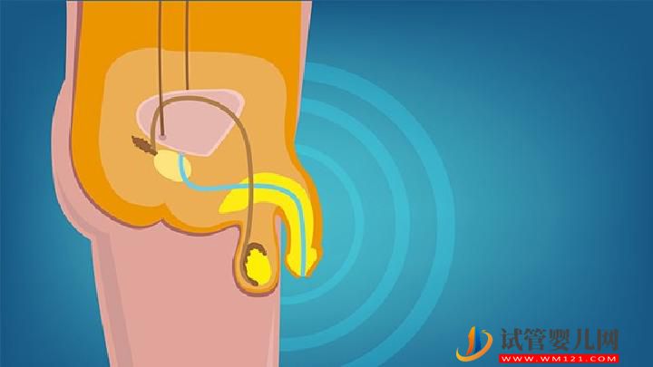 治療性功能障礙有哪些方法？男性性功能障礙的飲食調理方法(圖2)
