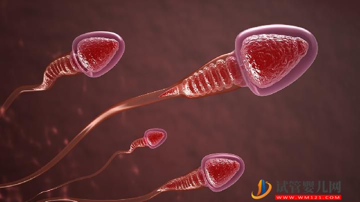 男性不育要做哪些檢查確診？常見的男性不育有哪些？(圖6)