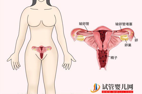 輸卵管阻塞是導致不孕的一大元兇，當出現這3個癥狀時需要注意了!(圖1)