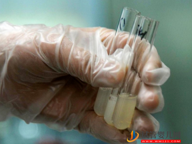 無精癥恢復(fù)生精功能并不困難,吃藥、手術(shù)都能有效解決(圖2) 無精癥恢復(fù)生精功能并不困難,吃藥、手術(shù)都能有效解決(圖2)