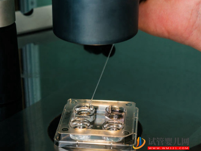 無精癥恢復(fù)生精功能并不困難,吃藥、手術(shù)都能有效解決(圖4) 無精癥恢復(fù)生精功能并不困難,吃藥、手術(shù)都能有效解決(圖4)