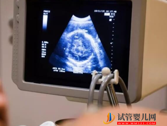 羊穿查出胚胎2號染色體基因突變會有哪些不良癥狀?(圖1) 羊穿查出胚胎2號染色體基因突變會有哪些不良癥狀?(圖1)