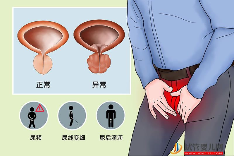 首創口服化療藥物能治療前列腺癌(圖1)