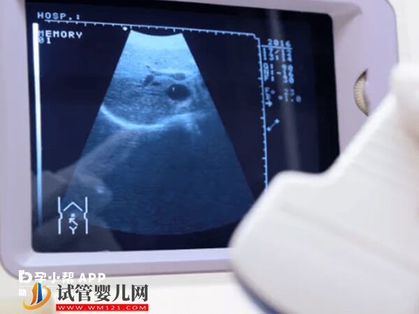 上海實力超強的試管嬰兒推薦，第一家妊娠率高達64%(圖2)