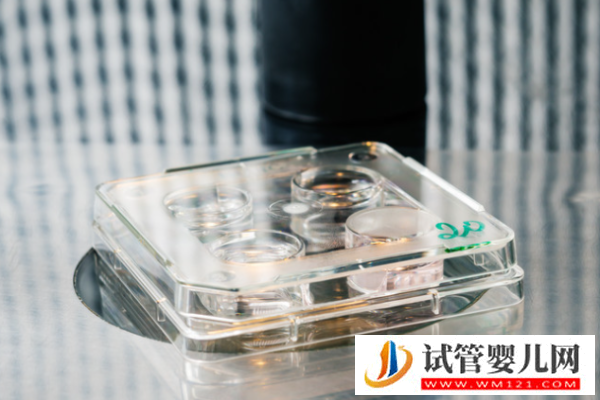 試管嬰兒謠言有哪些?打破這5大謠言,放心試管!(圖2) 試管嬰兒謠言有哪些?打破這5大謠言,放心試管!(圖2)