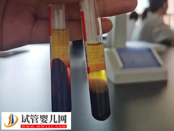 凍胚移植hcg翻倍對照表，雙胎翻倍時間居然比單胎長那么多(圖3)