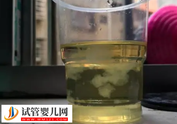 懷孕50天測(cè)男女土方法,酒精加尿液的酸堿度可以判斷(圖2) 懷孕50天測(cè)男女土方法,酒精加尿液的酸堿度可以判斷(圖2)