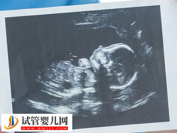 上海集愛醫院助孕步驟分享，掛號到驗孕流程匯總(圖1)