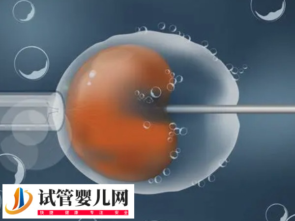 在俄羅斯做試管步驟是什么(圖3)