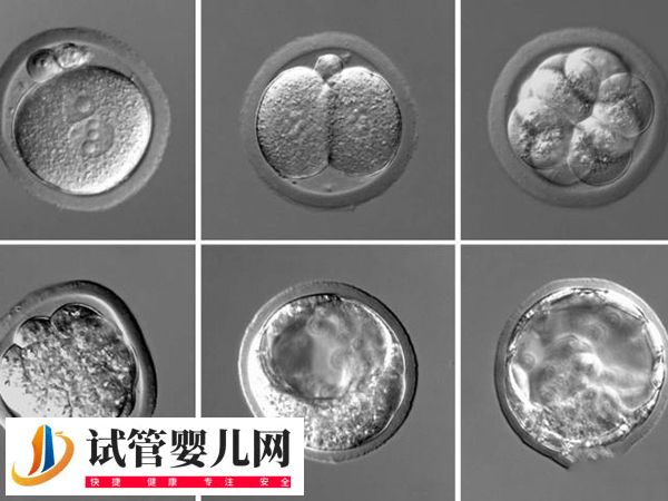 在美國做試管優質胚胎是啥樣的(圖3)