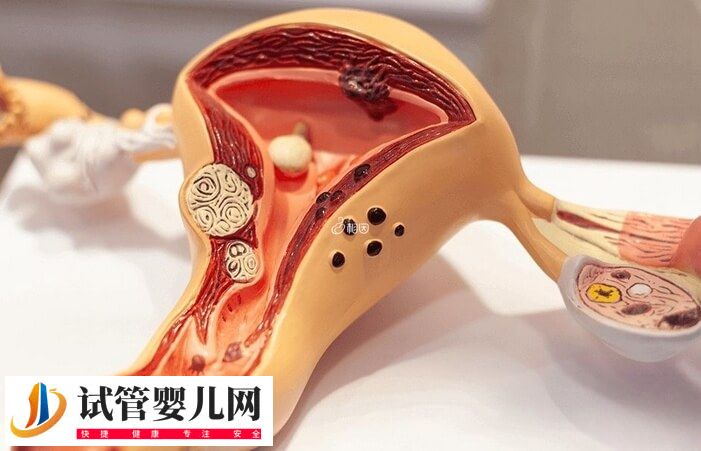 宮腔粘連在南寧做試管需要多少錢