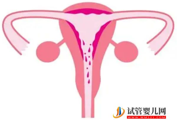 三代試管嬰兒 第二代和三代試管嬰兒的區(qū)別是什么?有什么優(yōu)勢(shì)?(圖1)